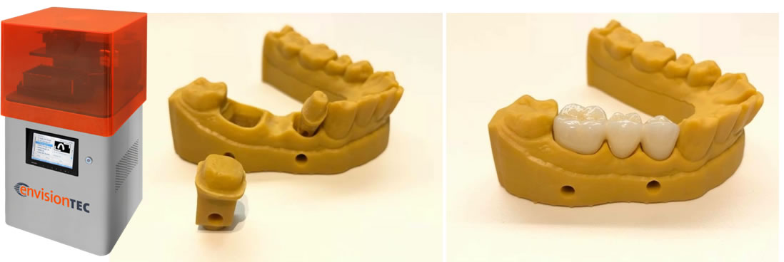 3Dプリンター